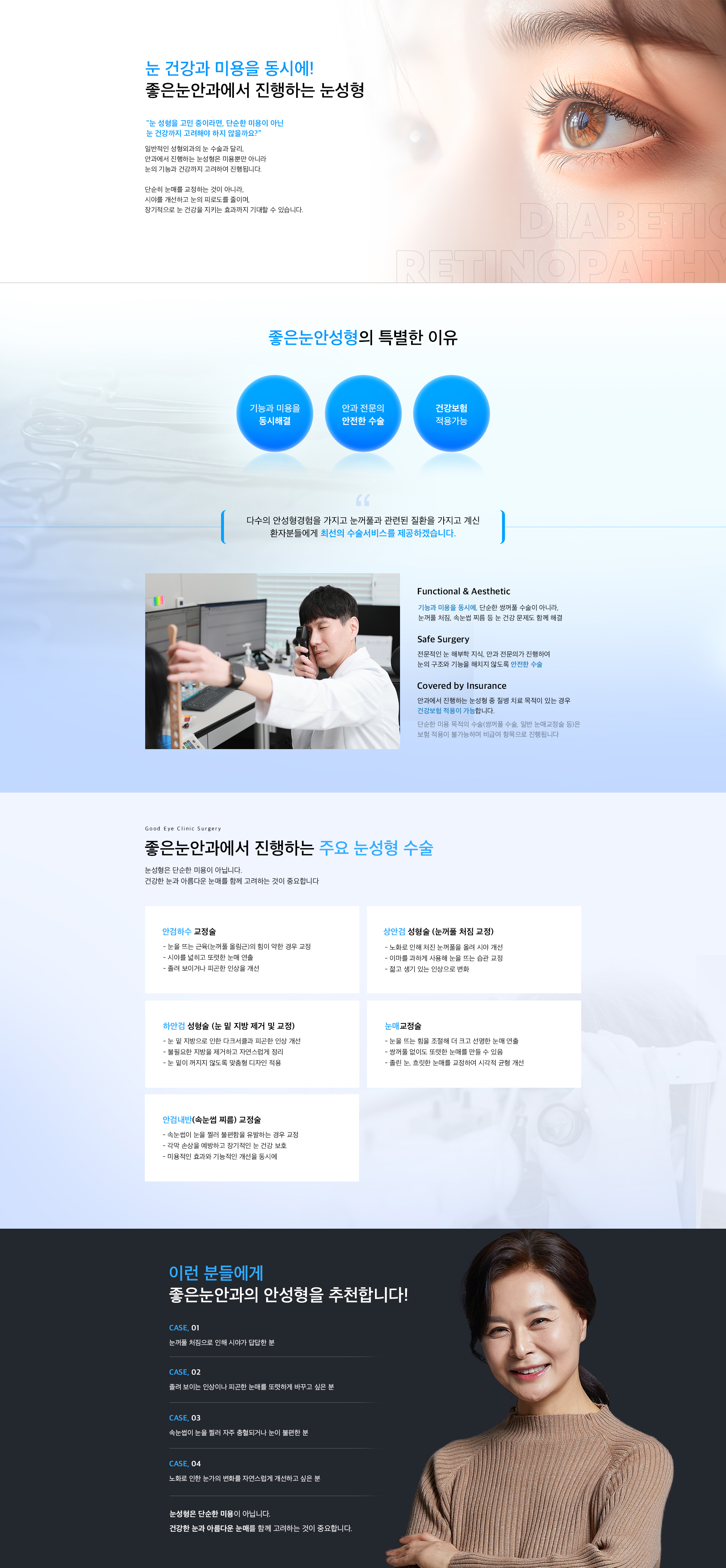 좋은눈안성형의 특징