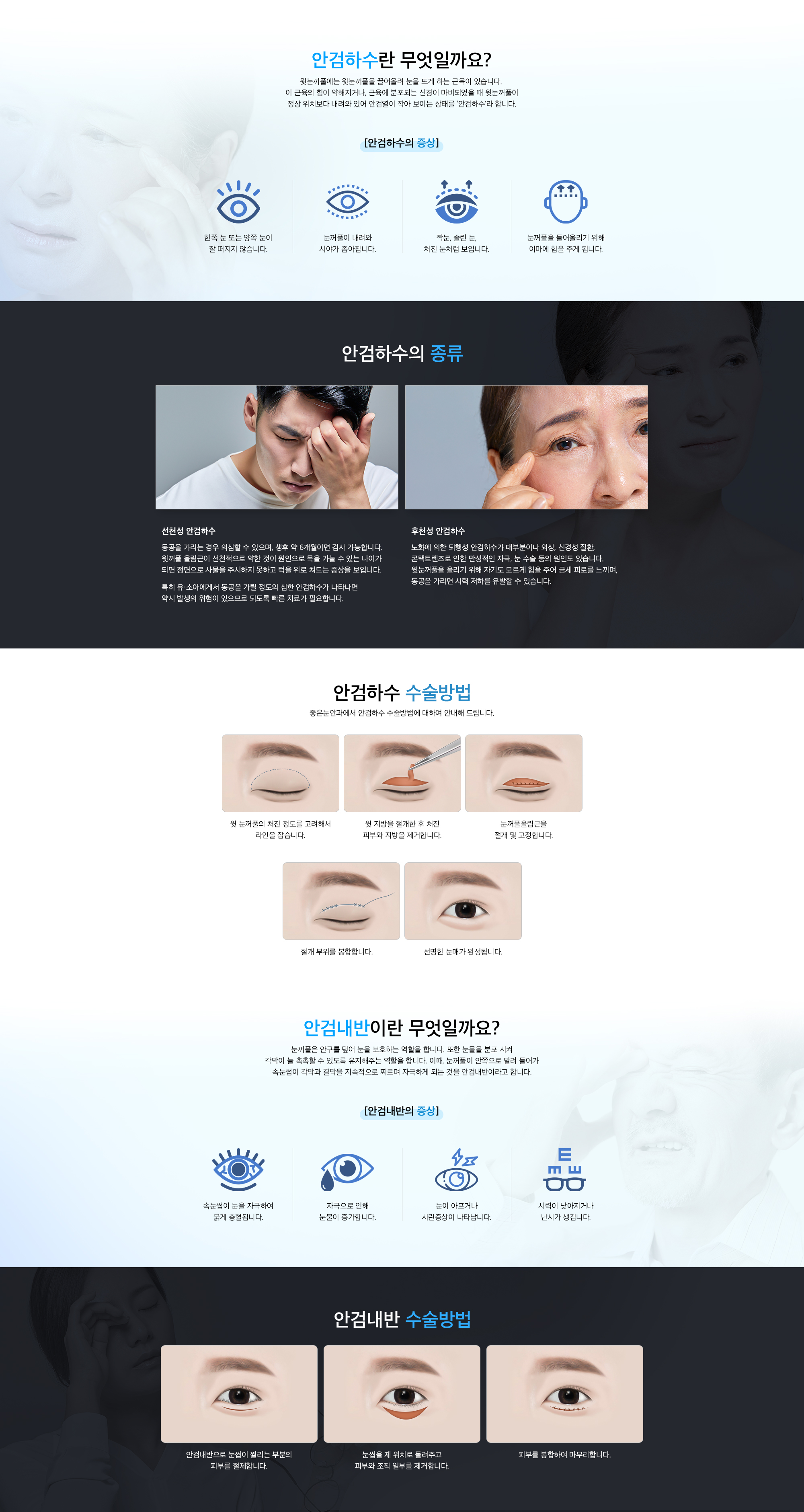 안검하수/안검내반